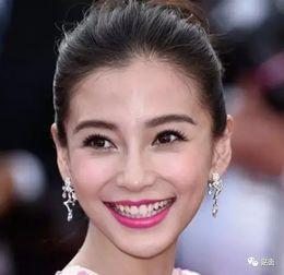 哪些明星整过牙,揭秘整牙前后颜值大逆袭的明星阵容